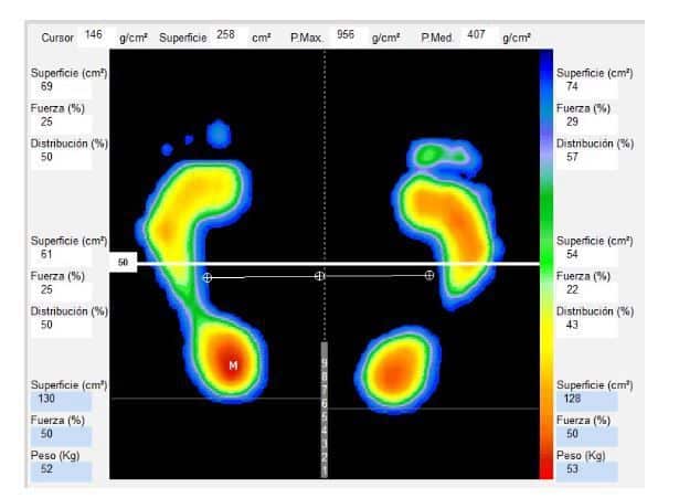 Estudi de la trepitjada Estudi de la trepitjada